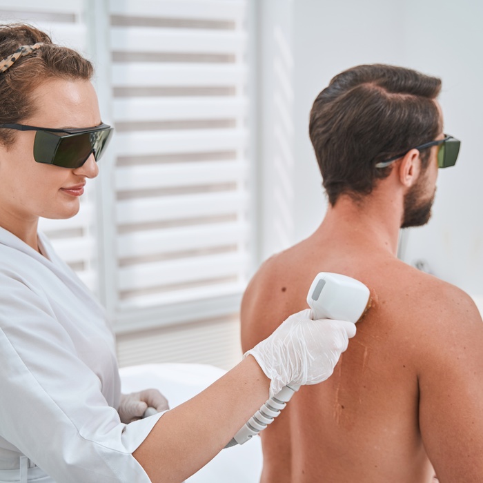 laser hair removal back