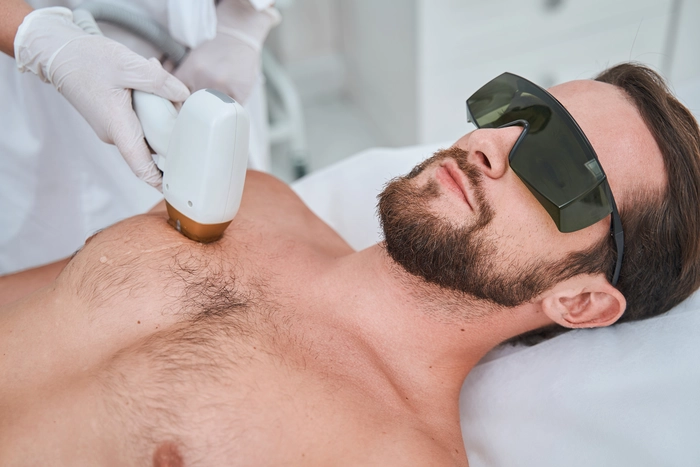 laser hair removal for chest