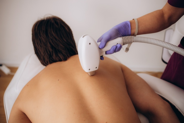 laser hair removal back