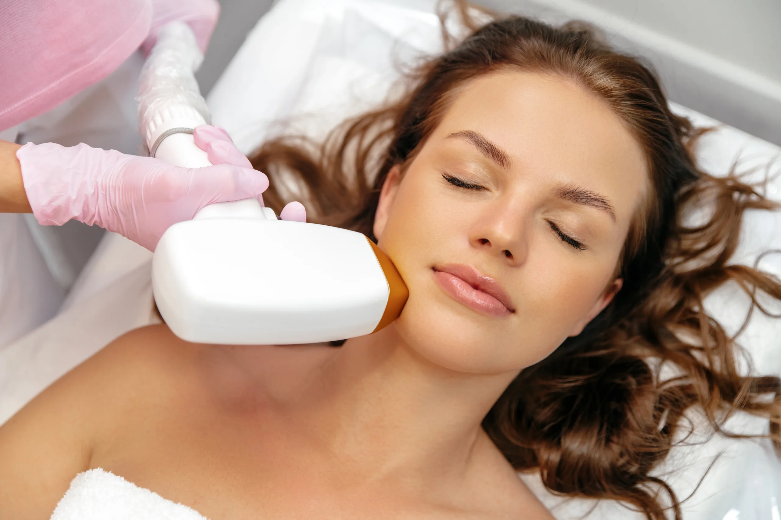 laser hair removal chin 02