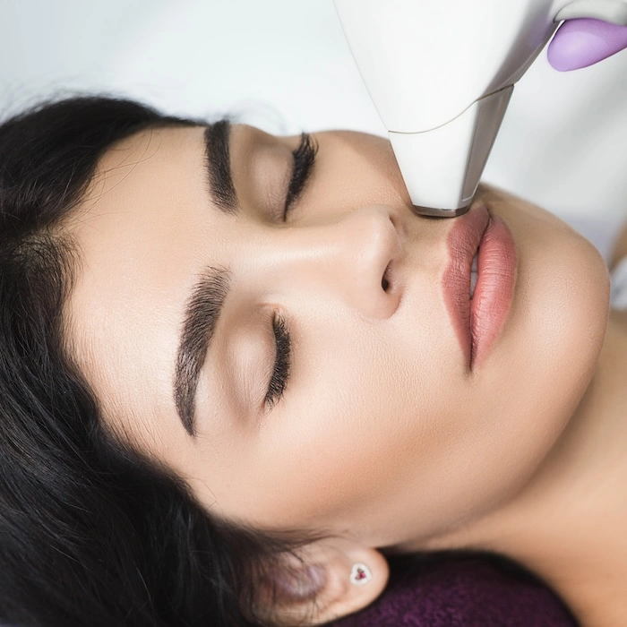 laser hair removal lips 02