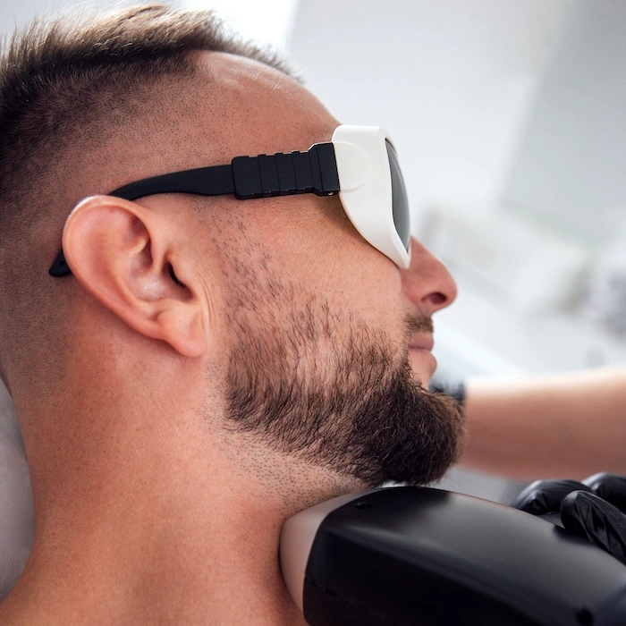 laser hair removal neck 02